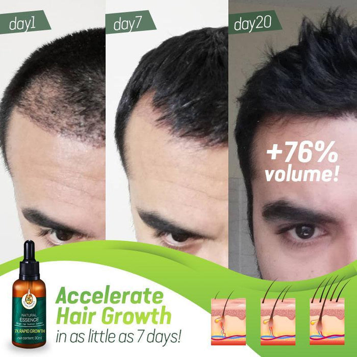 7X Rapid Growth Hair Treatment
