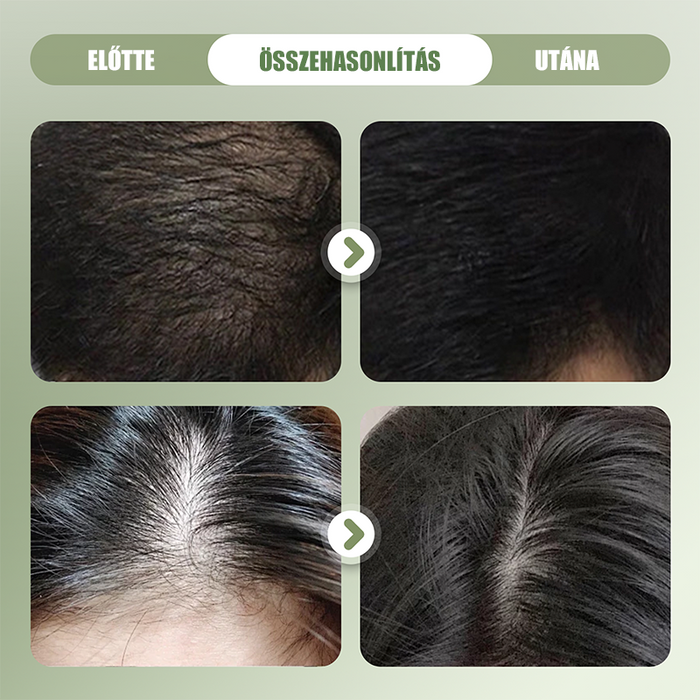 Barra de champú natural para fortalecer el cabello 🌱🥰-ES
