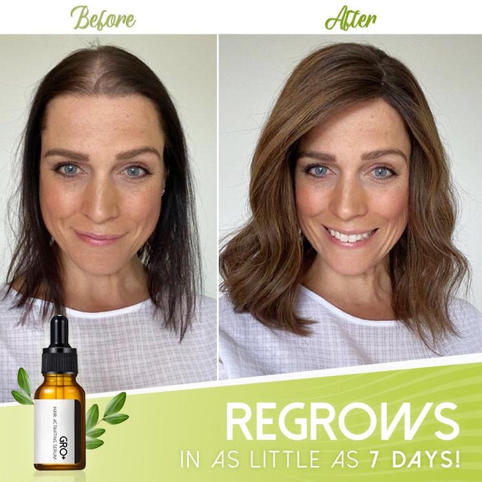 Gro Plus Hair Activating Serum For Thinning Hair Regrows Thicker Fuller Hair In 7 Days