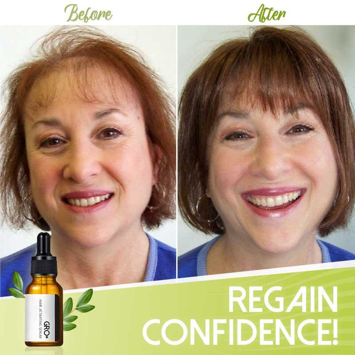 Gro Plus Hair Activating Serum For Thinning Hair Regrows Thicker Fuller Hair In 7 Days