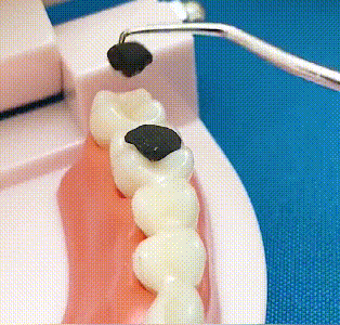 🦷 Juego de palillos de acero inoxidable-ES