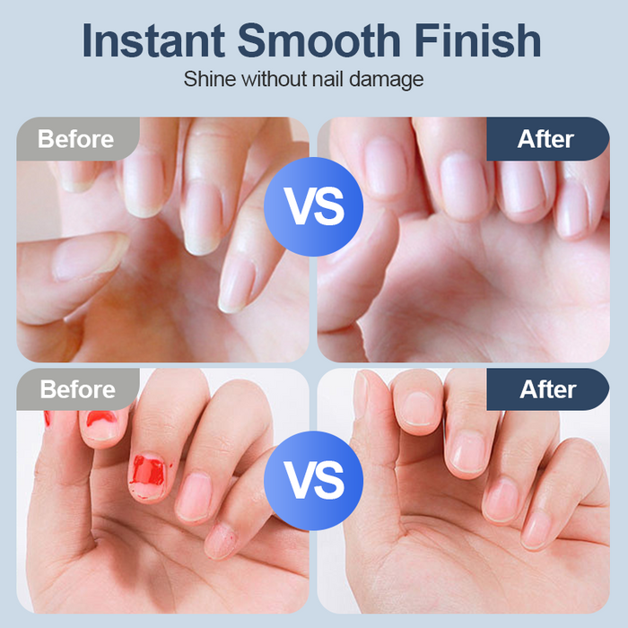 Lima de uñas automática universal para adultos y niños-ES