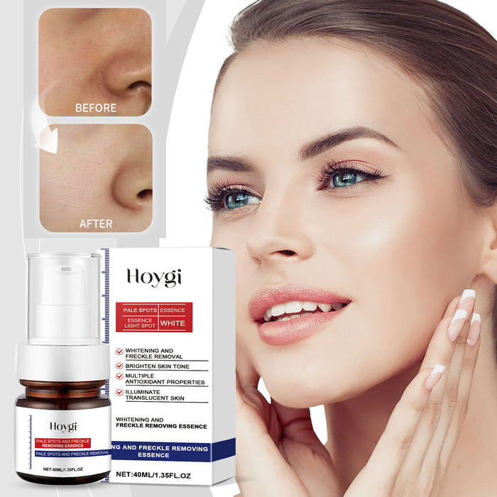 🔥[Limited time offer, buy one get one free]🔥 Vitamin C cream for skin lightening and fighting freckles, melasma and dark spots, for clearer skin.