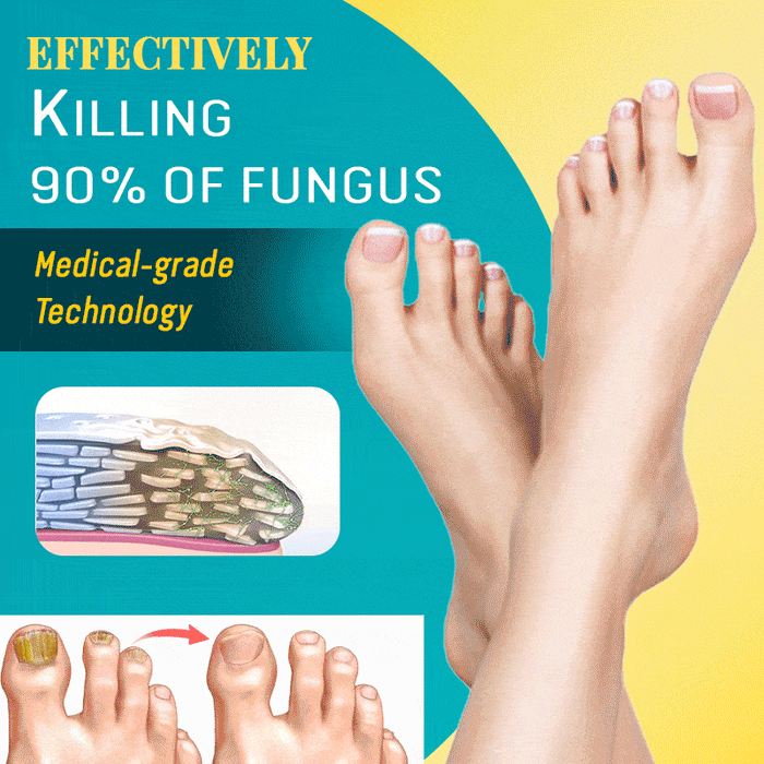 NailRenew™ Anti-fungal Treatment Set
