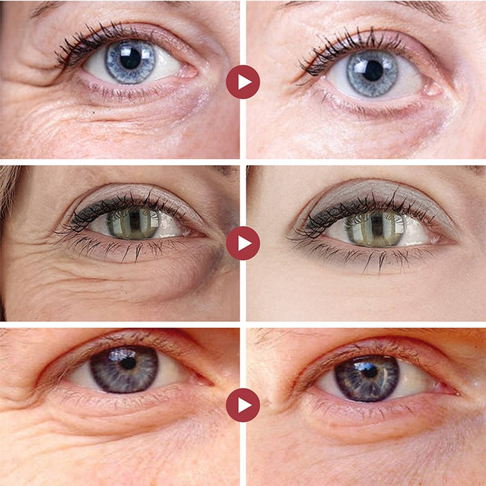 Professional Retinol Anti-Wrinkle Eye Cream