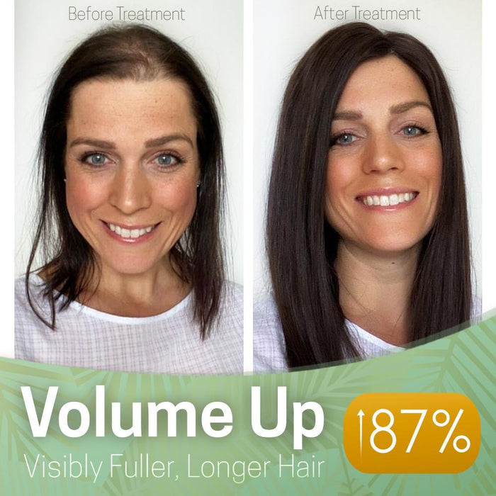 ReGrowth Nourishing Ginger Hair Spray