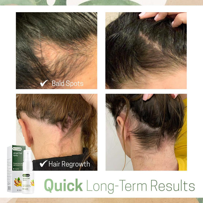 ReGrowth Nourishing Ginger Hair Spray